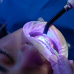Uleiul de cocos pentru igiena orală: mit sau miracol